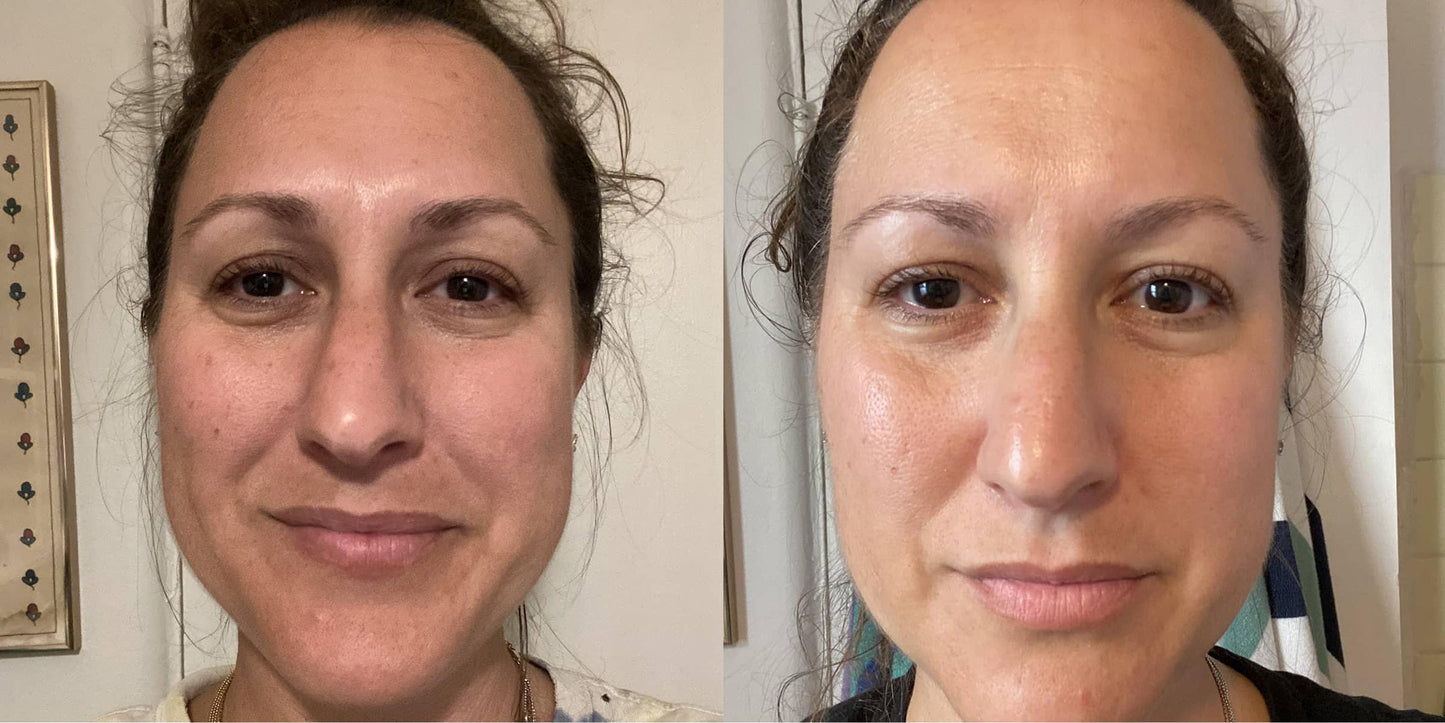 Only Radiant Collagen Glow Cream – Anti-Aging Moisturizer